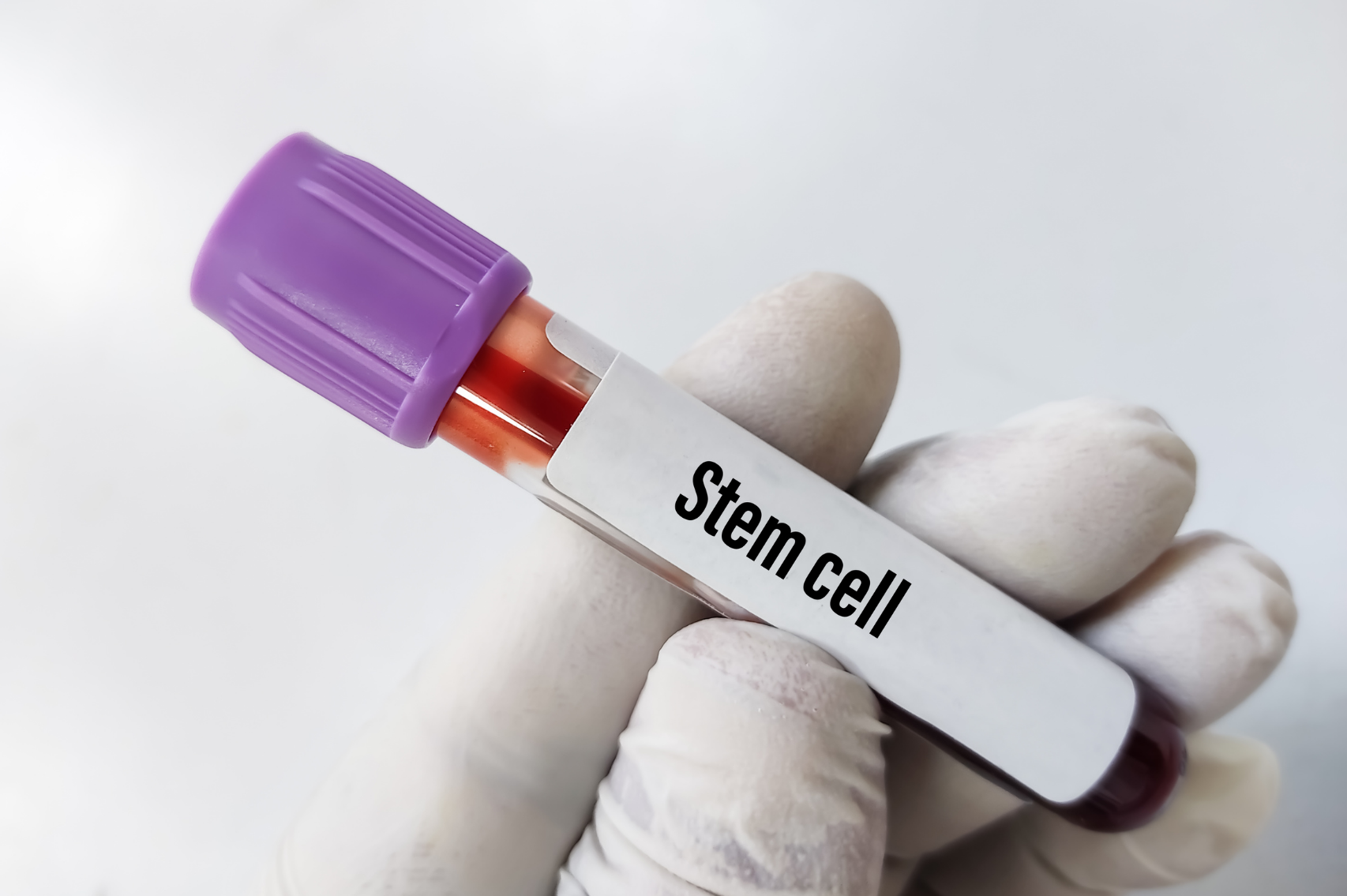 Stem Cell Vial