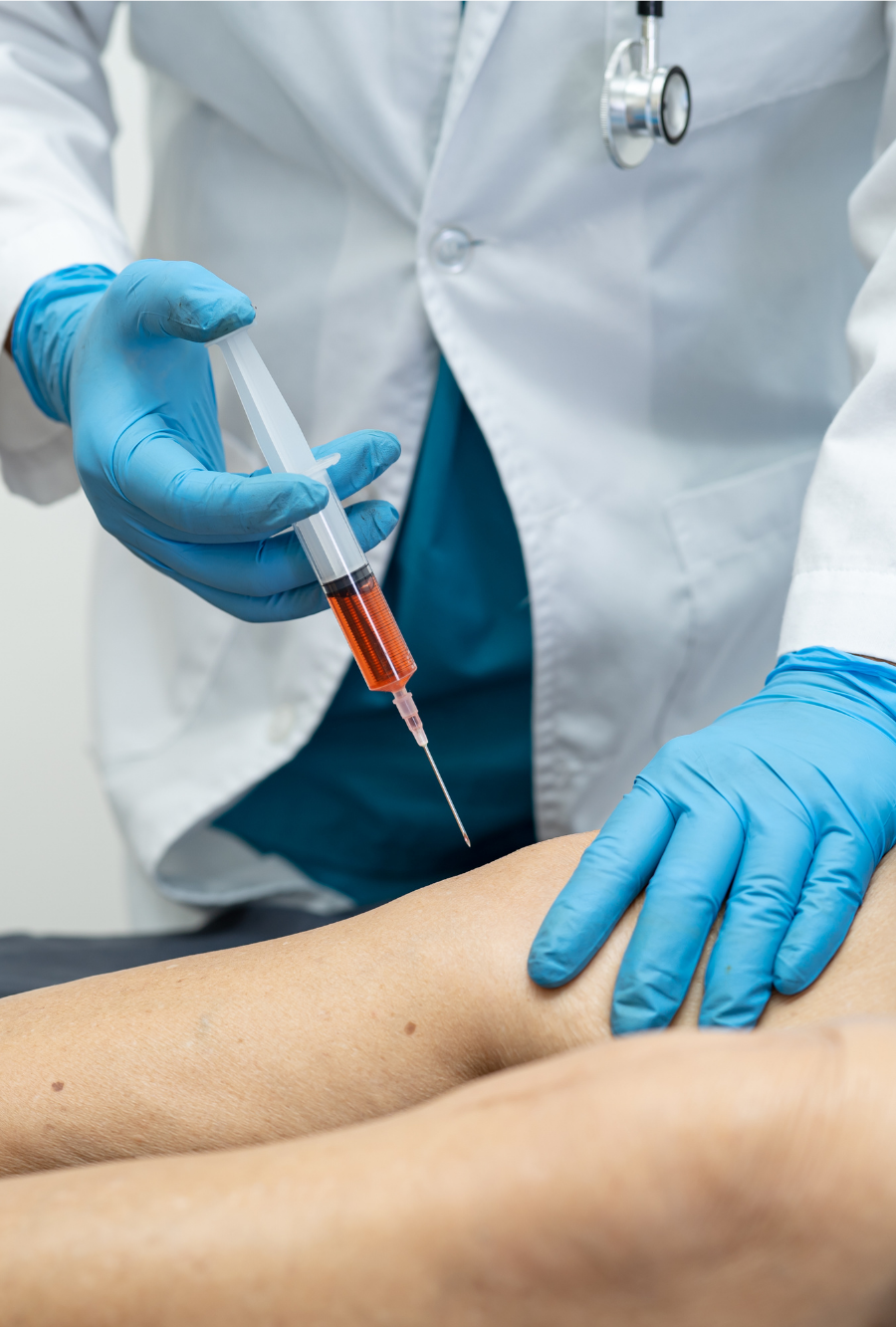 Stem Cell Therapy
