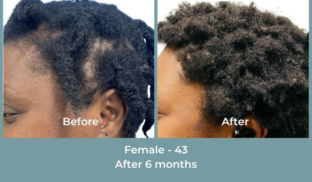 Facebook Ads 1080x1080 GetHairMd - 100