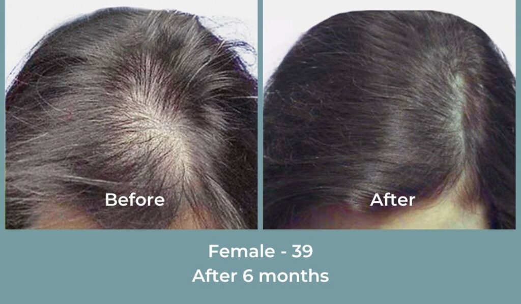 Facebook Ads 1080x1080 GetHairMd - 99