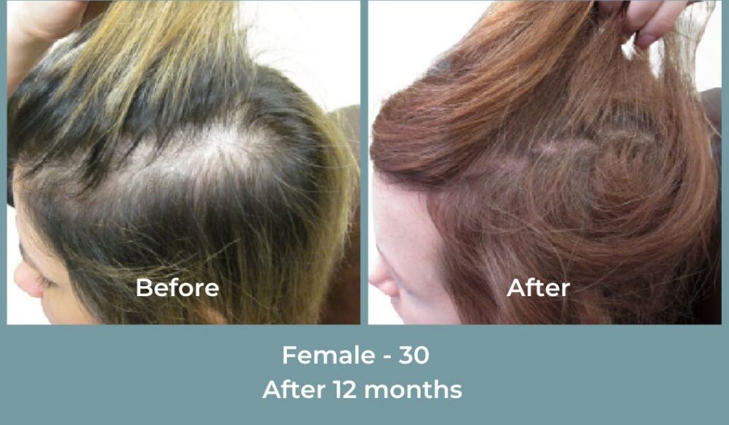 Facebook Ads 1080x1080 GetHairMd - 96