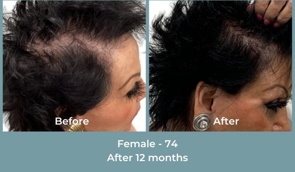 Facebook Ads 1080x1080 GetHairMd - 91